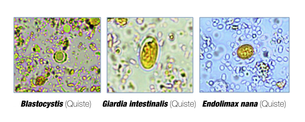 Blastocystis: parásito intestinal que está afectando a la población